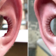 Hole Ears