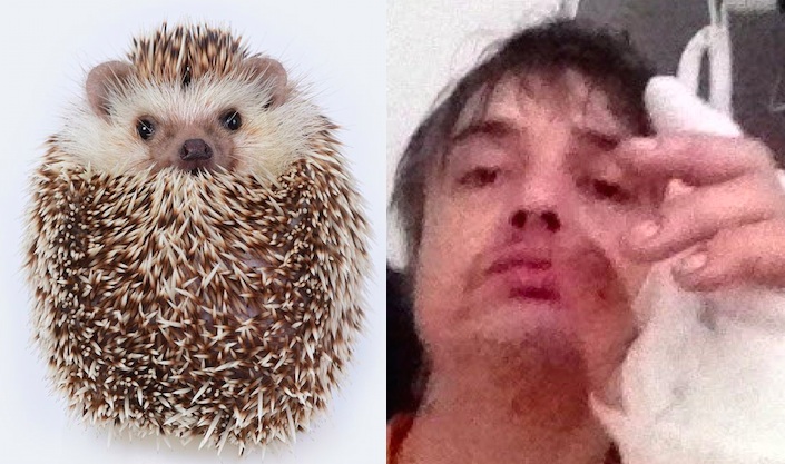Pete Doherty hedgehog