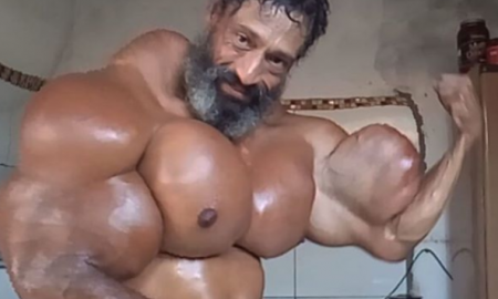 synthol injectat în penis