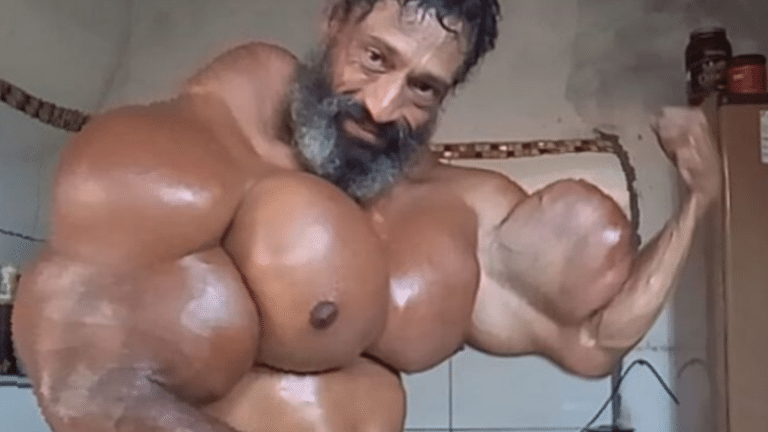 Here’s Another Weird Brazilian Bodybuilder Injecting Loads Of Synthol Into His Muscles