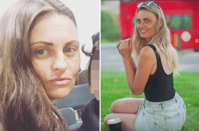 This Woman Is Showing Off About How She Tricked The NHS Into Giving Her A Free Nose Job