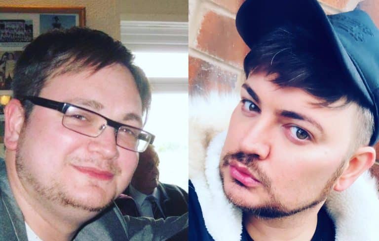 A Former Alan Carr Lookalike Spent £20,000 On Cosmetic Procedures To Break Into TV