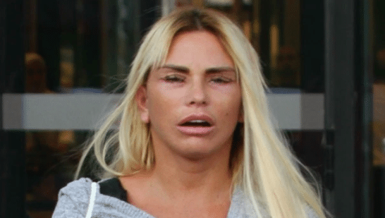 Katie Price face lift