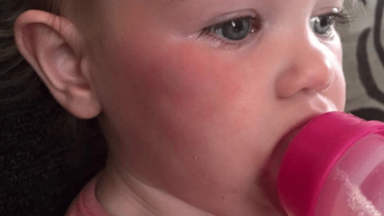 Mother Left Devastated After Seagulls Kill Dog And Leave Baby With Horrific Facial Injuries