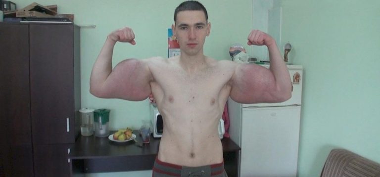 Russian ‘Popeye’ Synthol Bodybuilder Competes In First MMA Match; Taps Out In Three Minutes