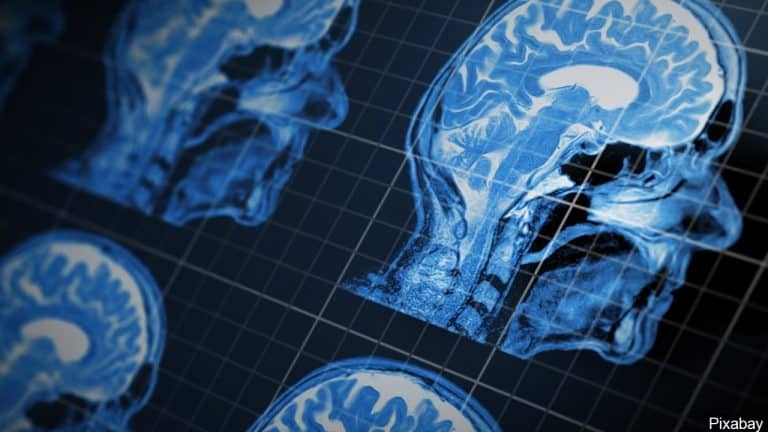 New Study: Thinking Too Much Can Cause You To Die Sooner