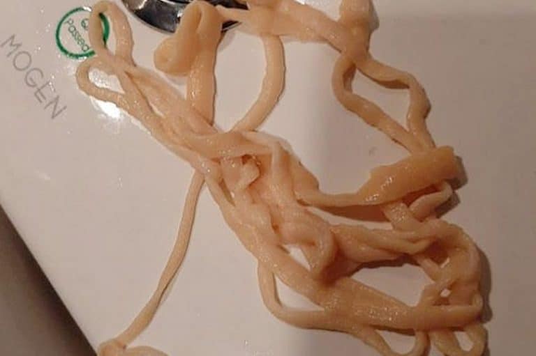 Man Pulls 32-Foot Tapeworm Out Of His Butt While Using The Toilet (NSFL)
