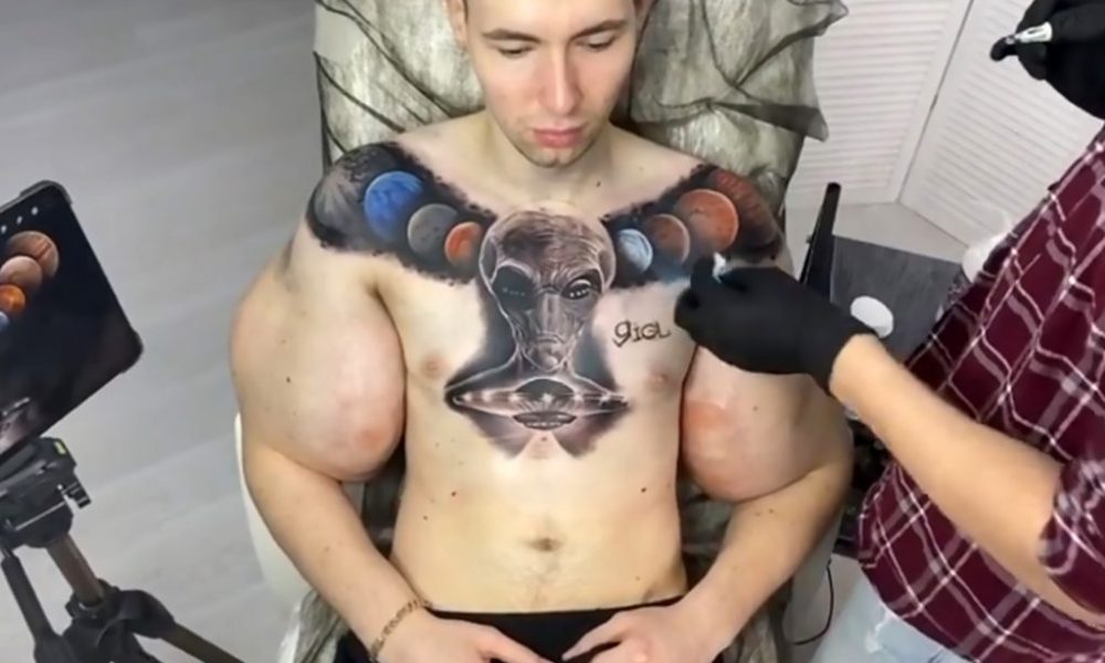 synthol injectat în penis fără erecție cu o femeie