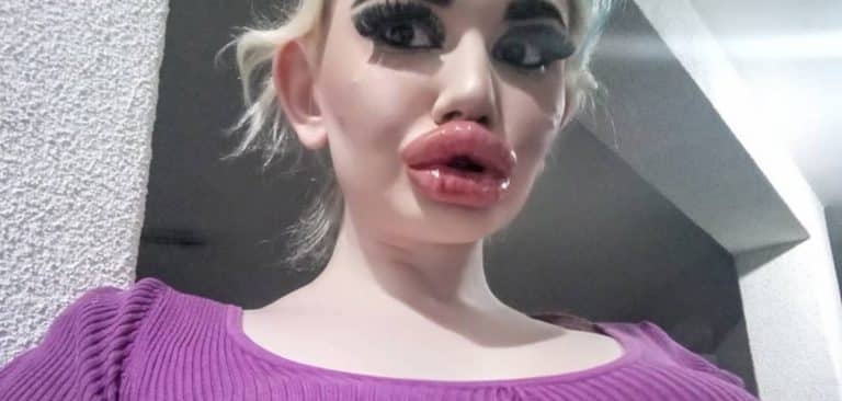 This Woman Has Spent Thousands On Trying To Get The ‘Biggest Lips In The World’