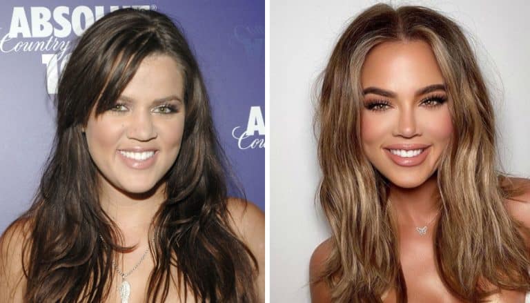 Khloe Kardashian’s Face Has Completely Transformed & No One Understands WTF Is Going On