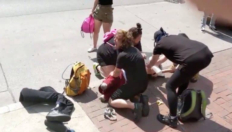 American Cops Pepper Sprayed A Double Amputee And Then Stole His Prosthetic Legs