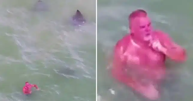 Drone Captures Footage Of The Man With The Worst Sunburn Ever