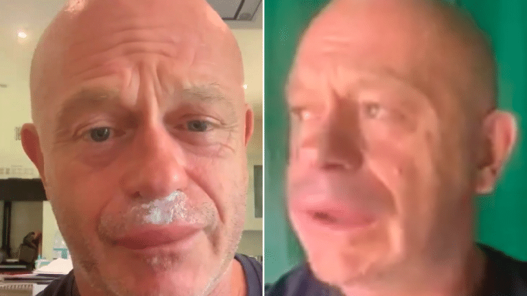 Ross Kemp Was Stung By A Bunch Of Wasps And His Lips Got Really Swollen