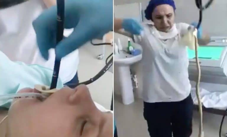 A Four Foot Long Snake Was Removed From A Woman’s Throat After It Crawled In While She Was Asleep