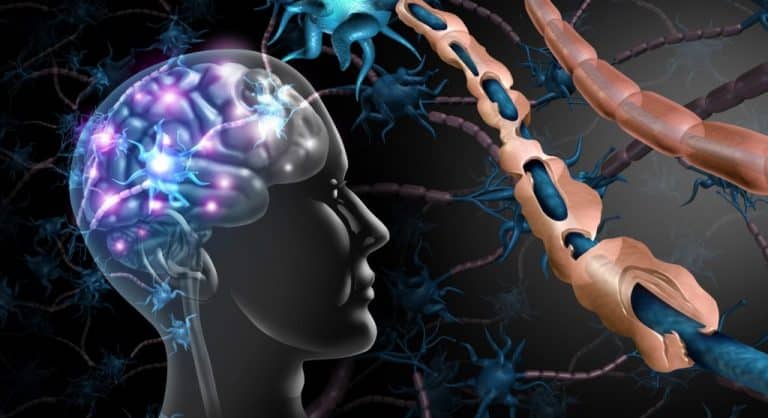 Tips For Living With Multiple Sclerosis