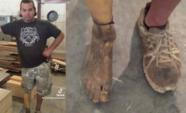 This Guy Definitely Needs His Foot Amputated – But Isn’t Having It