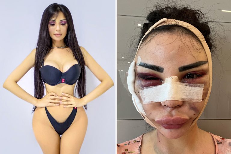 Woman Spends $600K To Look Like Kim Kardashian; Now Spending $120K To ‘Detransition’
