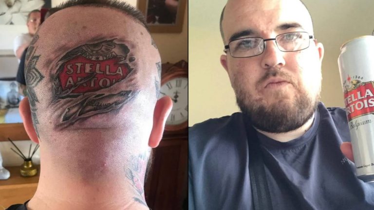 This Guy Got A Stella Artois Logo Tattooed On The Back Of His Head To Prove How Much He Loves Drinking It