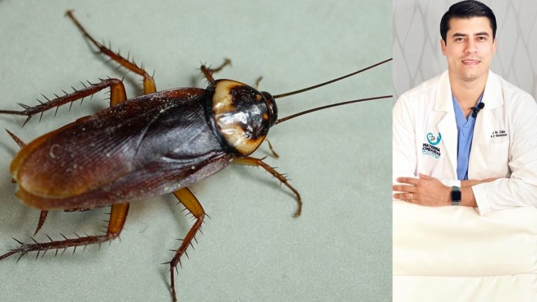 Gynaecologist Shocked To Find Cockroach Living In Patient’s Vagina