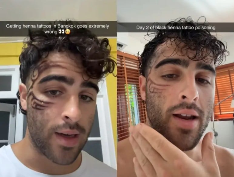 TikToker Gets Black Henna Mike Tyson Face Tattoo In Thailand, Finds Out It’s Illegal & Leads To Permanent Scarring